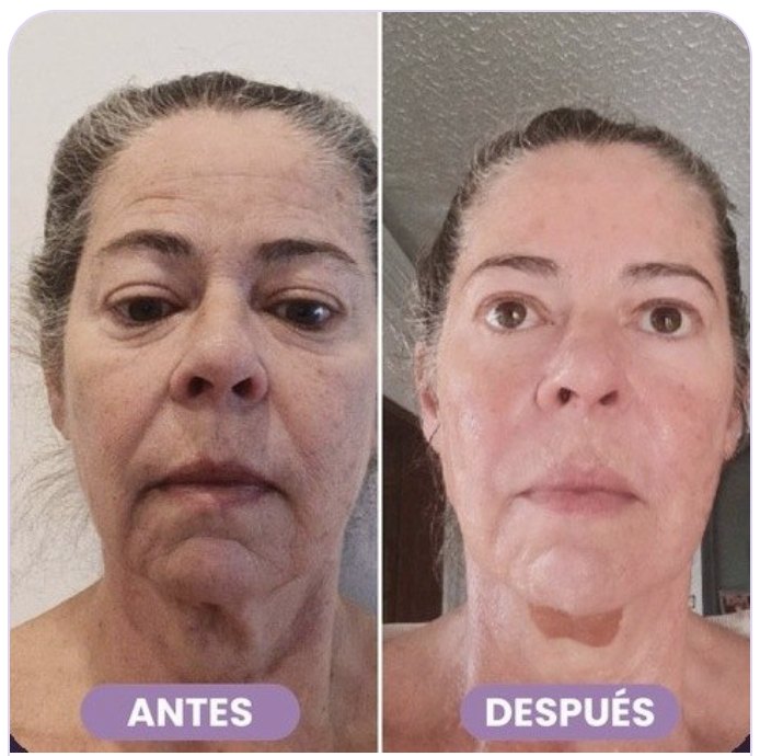Antes y después de Any