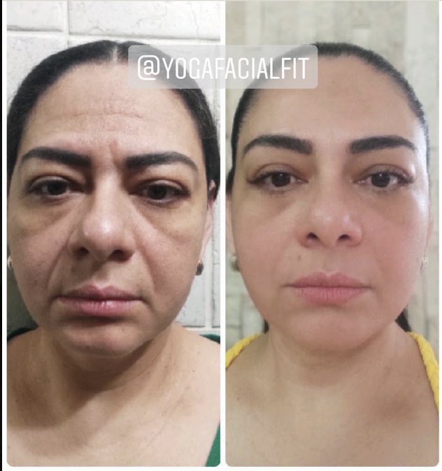 Antes y después de Sandra
