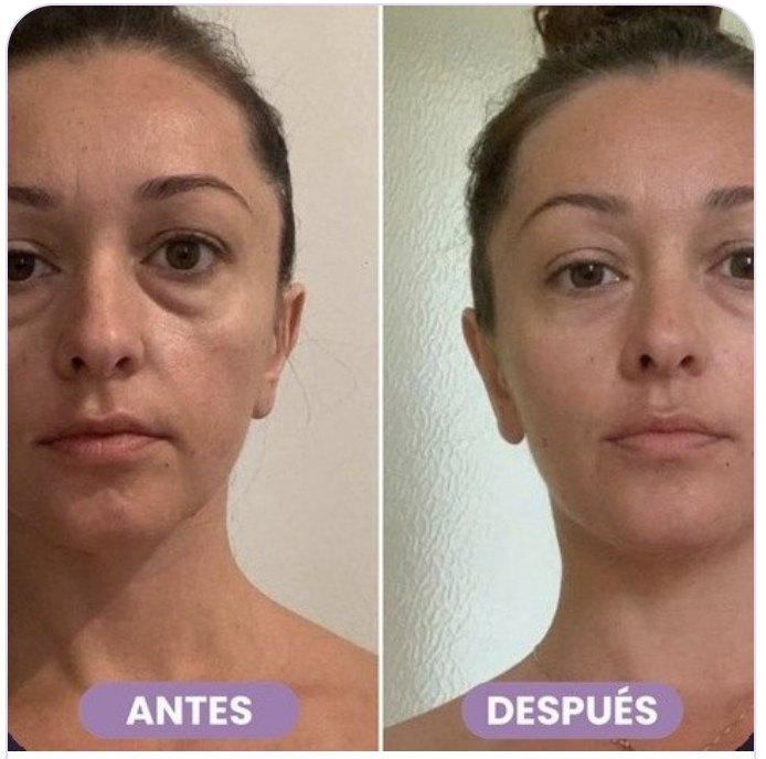 Antes y después de Soraya