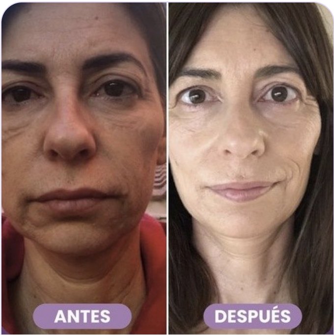 Antes y después de Susana