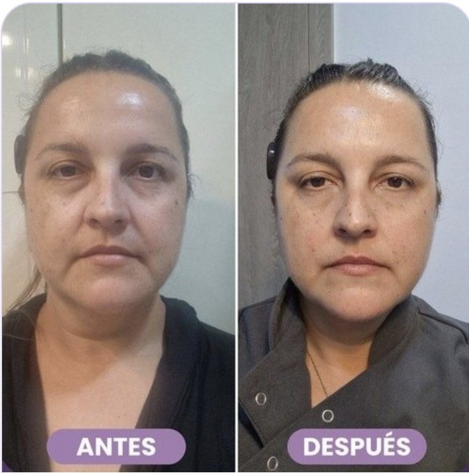 Antes y después de Teresa
