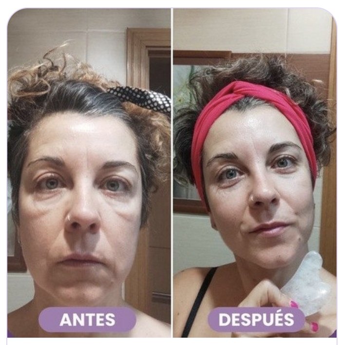 Antes y después de Vanesa